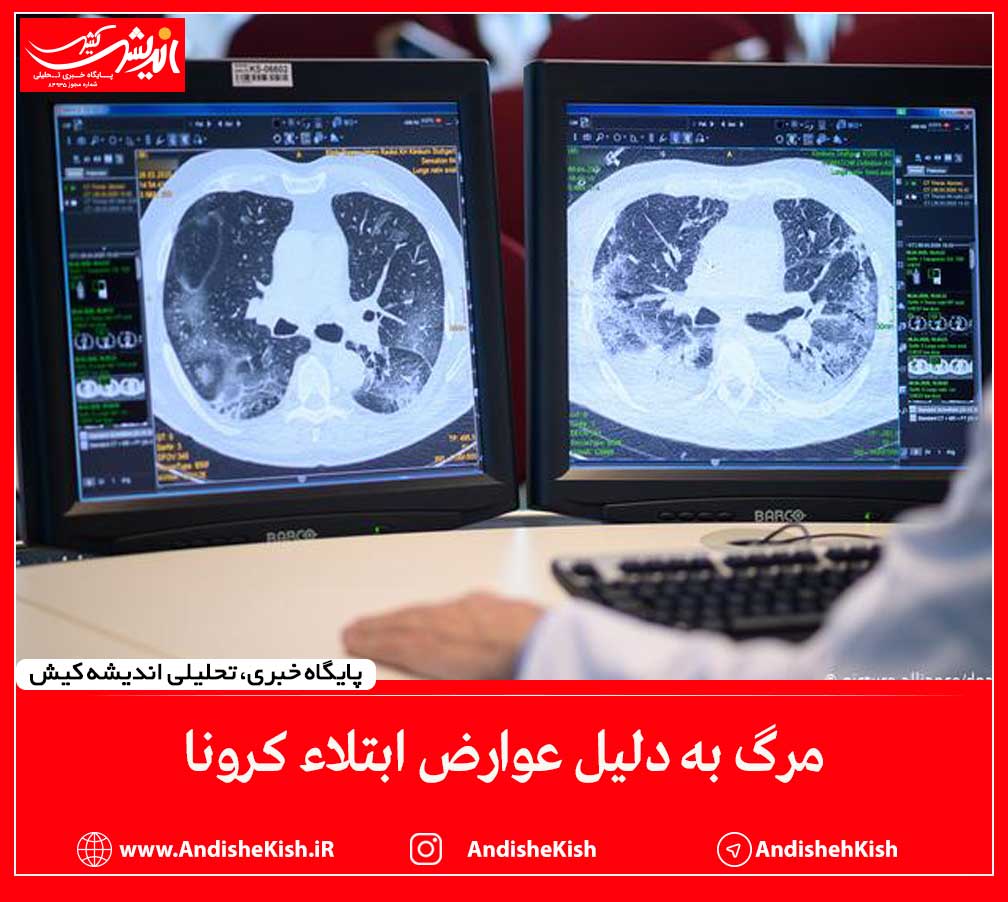 مرگ به دلیل عوارض ابتلاء کرونا