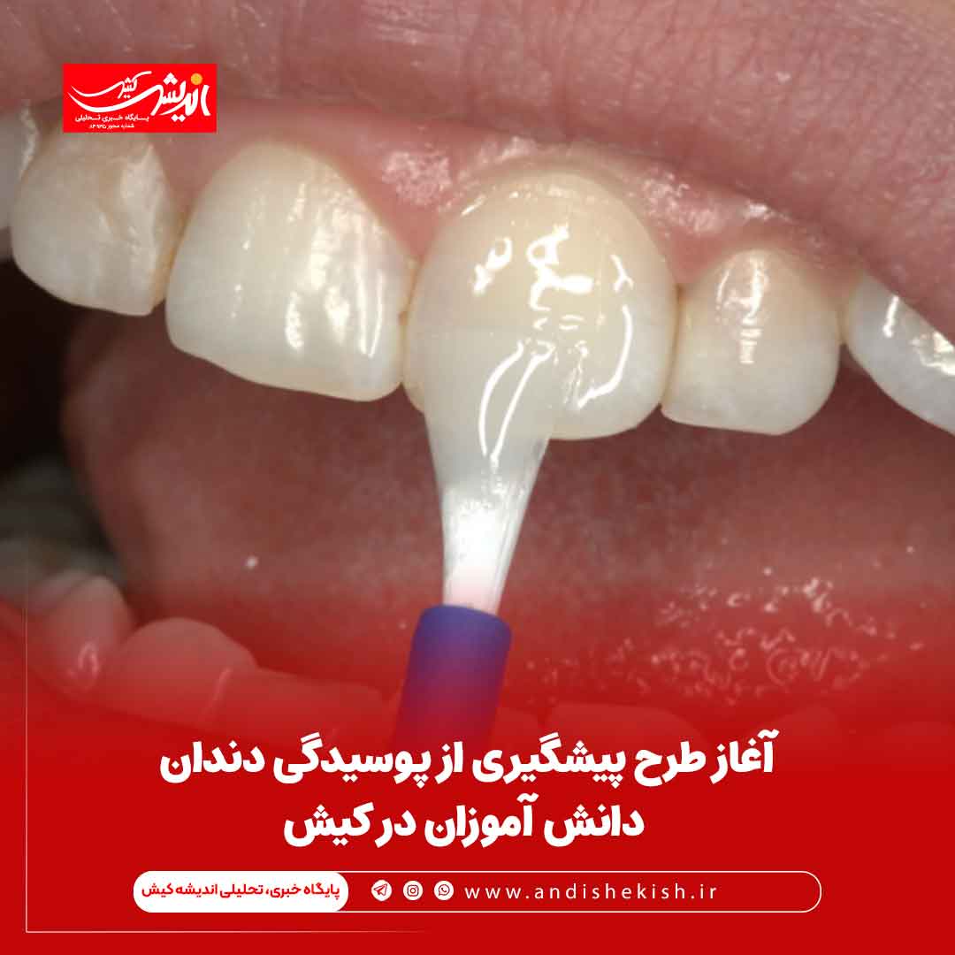 آغاز طرح پیشگیری از پوسیدگی دندان دانش آموزان در کیش